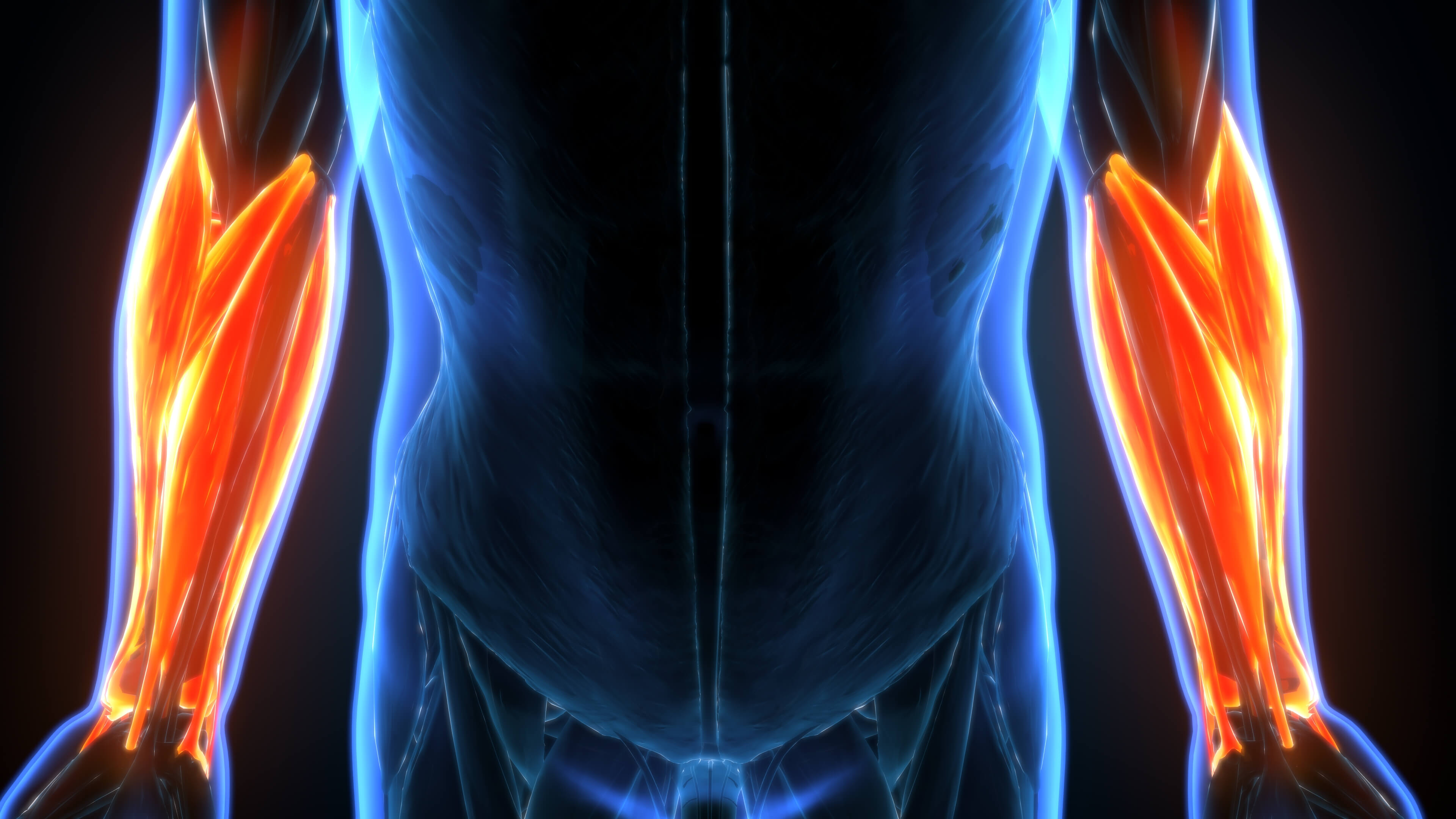 STS (soft tissue sarcoma) suffering arm muscles highlighted in a medical diagram
